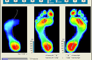 Enhance Byford Podiatry Use TOG GaitScan for Diagnosis
